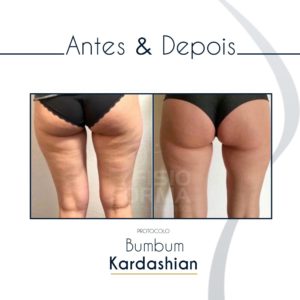 Resultado Bumbum Kardashian